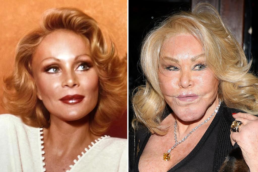 'Catwoman' Jocelyn Wildenstein strangely insists she 'never' had plastic surgery: report